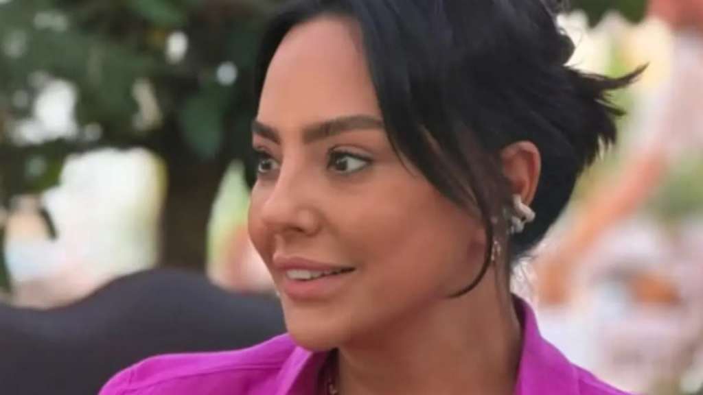 Ebru Gündeş’in estetik sonrası yeni hali gündem oldu
